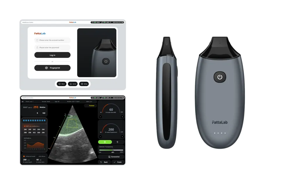 FattaLab® 脂肪肝诊断设备