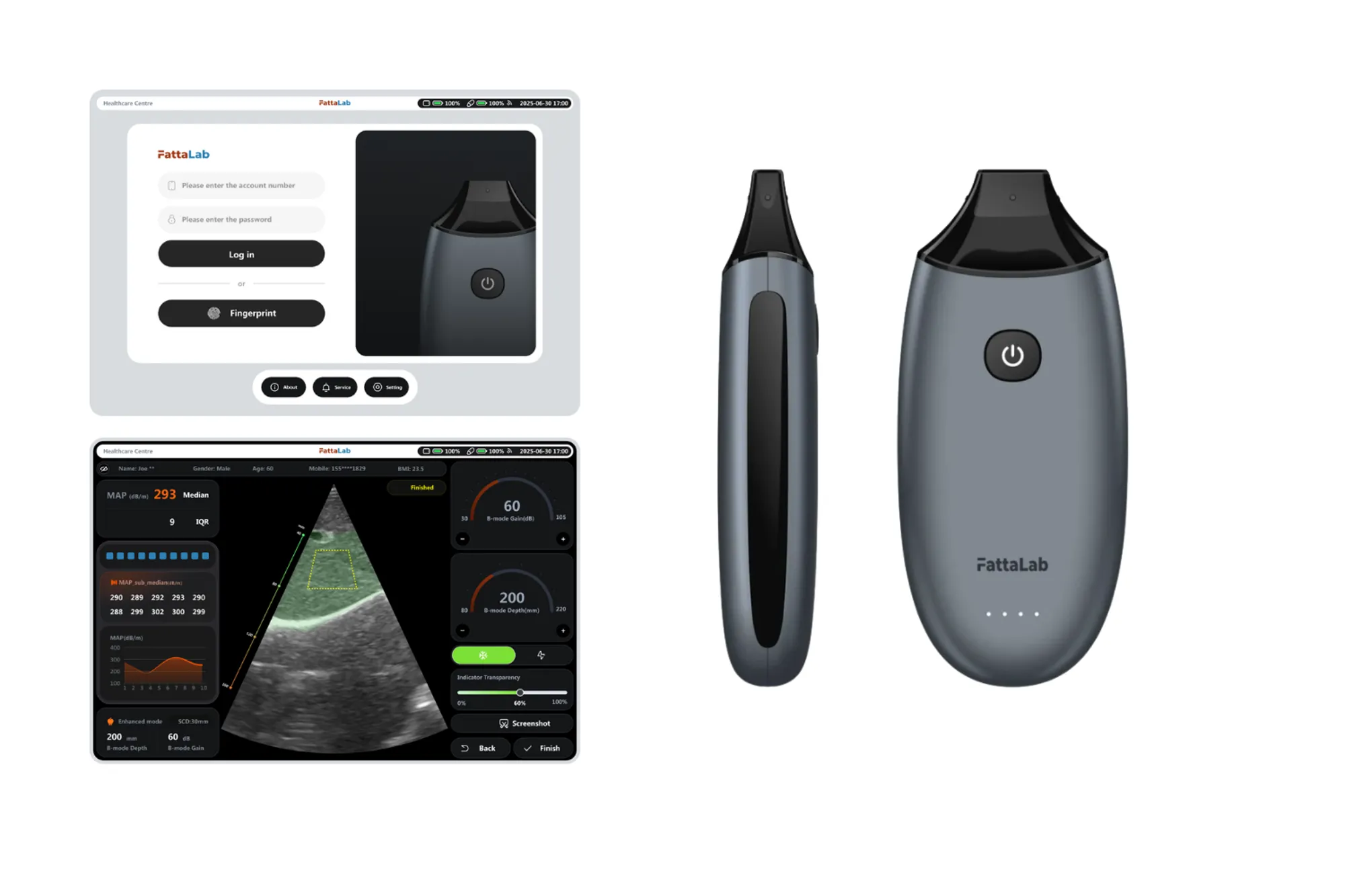 Fatets Lab FattaLab® Fatty Liver Diagnostic Device