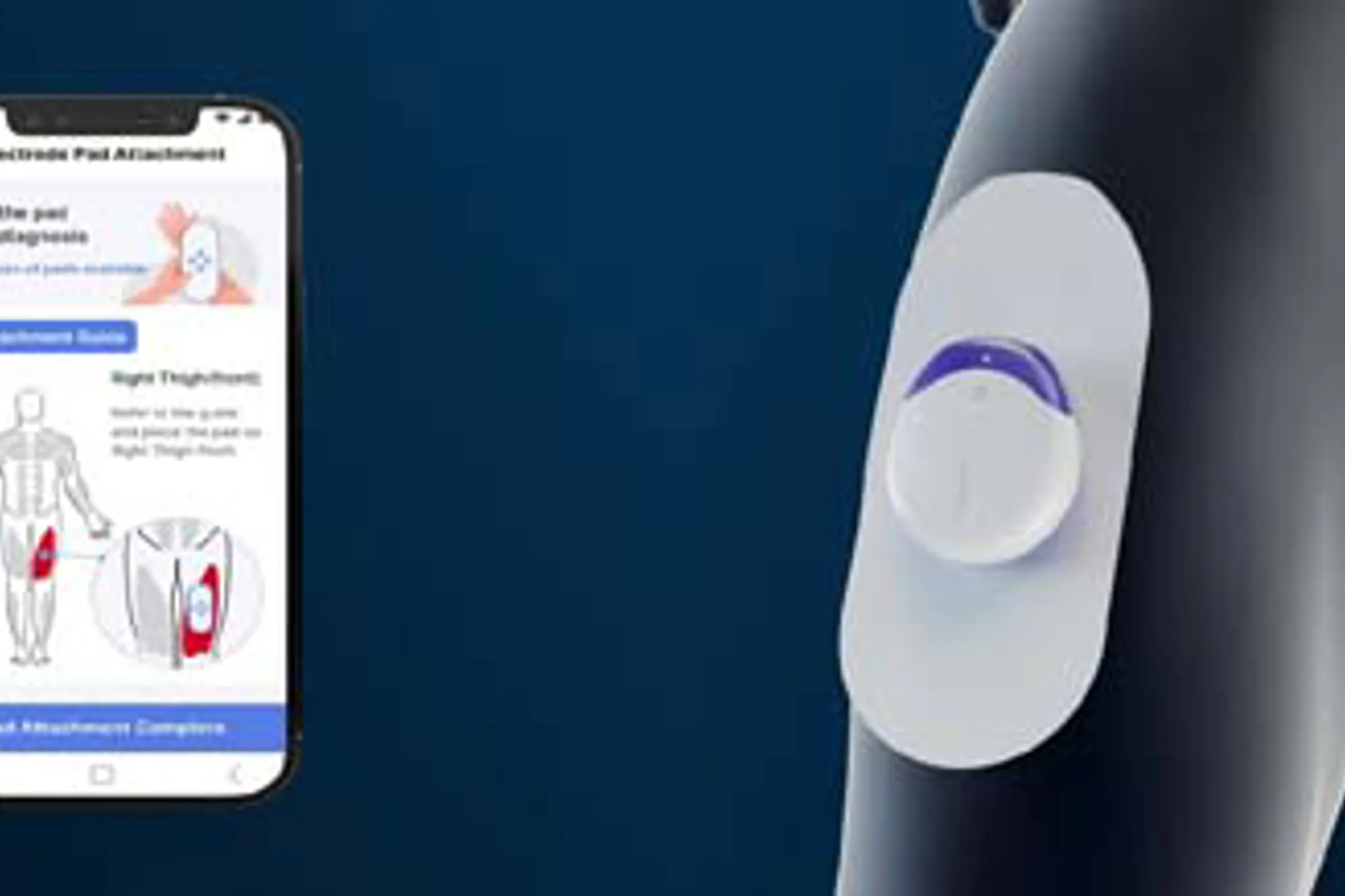 Illustration of Ai-Based Health Coaching For Tmj Disorder Management