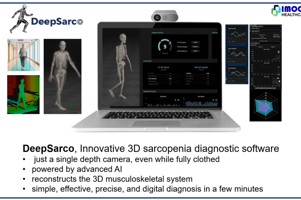 DeepSarco:3D AI 肌少症诊断