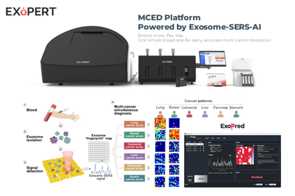 外泌体-SERS-AI 多癌种早期检测(MCED)平台