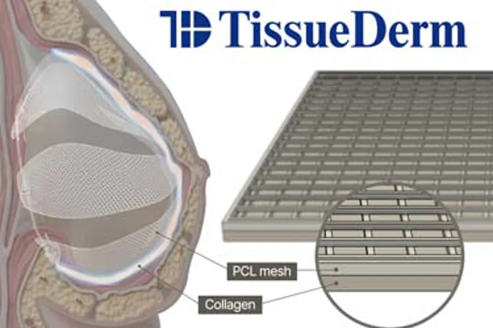 TissueDerm (粉色重生)