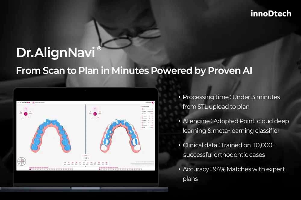 Dr.AlignNavi:从扫描到方案,只需数分钟